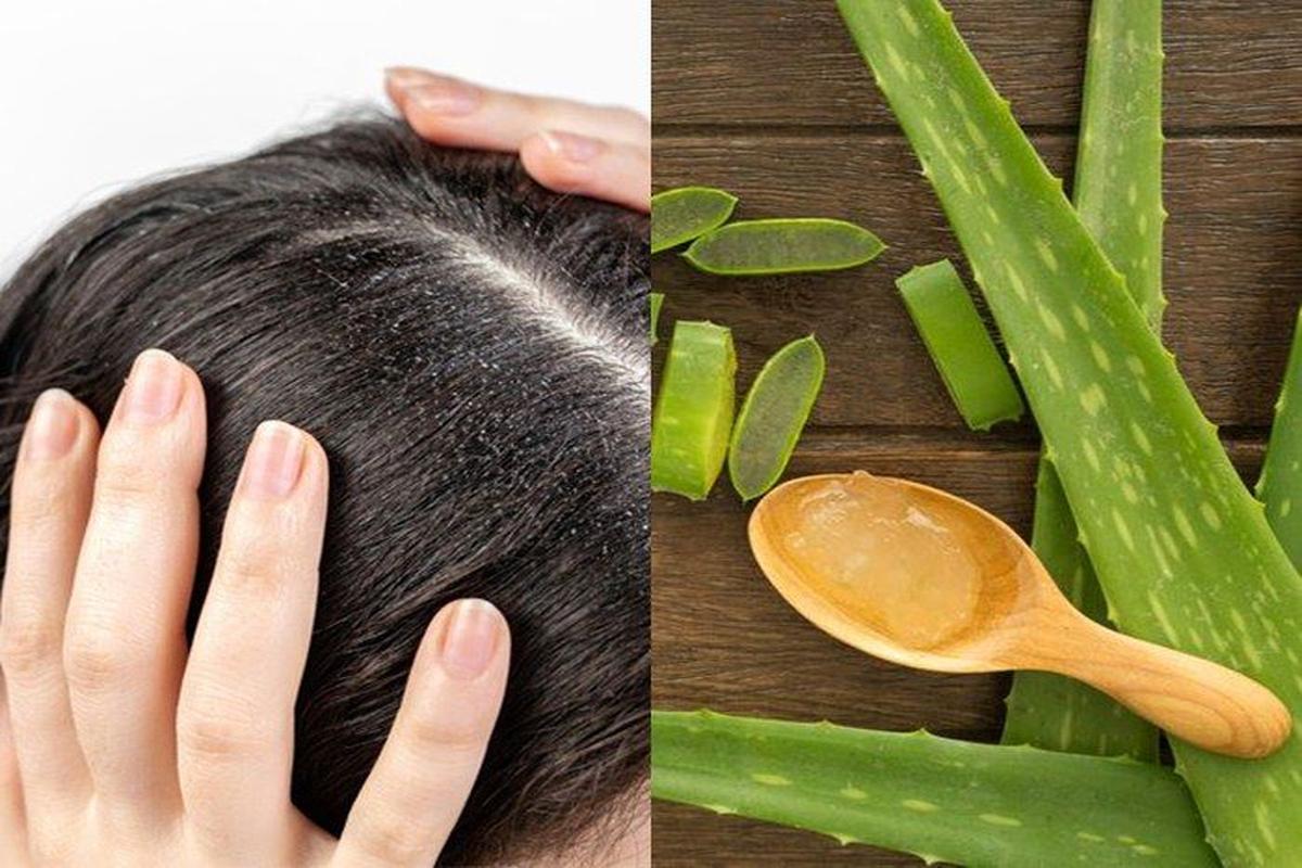manfaat lidah buaya untuk rambut